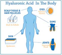 Hyaluronic acid-2 Hyaluronic acid-2